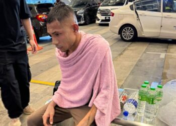 KEADAAN Faisal Abdul Halim selepas di simbah asid  oleh individu tidak dikenali baru-baru ini.